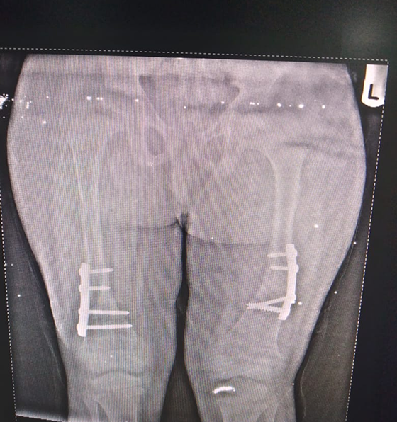 Hip & Knee image